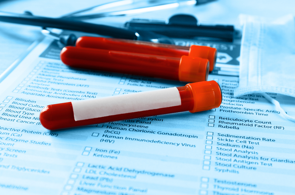 Home Health Perspectives on Alzheimer’s Biomarkers