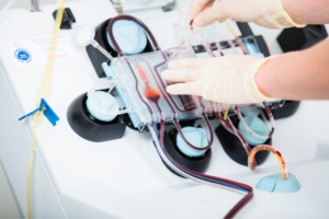 Plasma Protein Fractionation