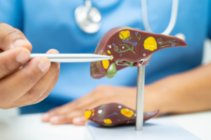Diagnostic Tools for MASH (Metabolic dysfunction-associated steatohepatitis) Patients