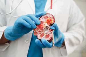 Autosomal Dominant Polycystic Kidney Disease