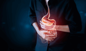 Gastrointestinal Stromal Tumor (GIST)