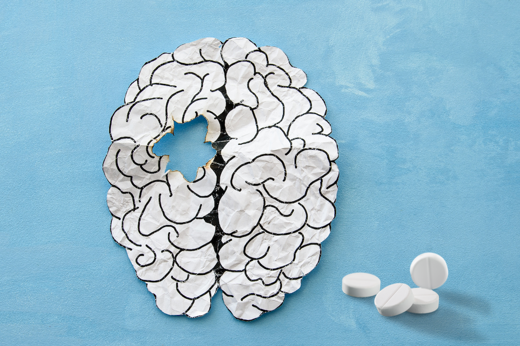 Interview Pre-Screening: Schizophrenia Treatment Patterns