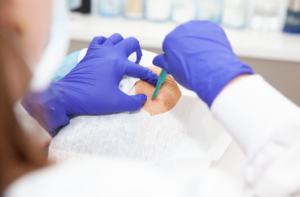 Bone Lesion Biopsy Challenges
